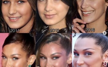 What Is Face Lift Tape, and How Do Celebrities Use This Beauty Hack